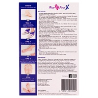 Milky Foot Active Exfoliating Foot Pads images 0