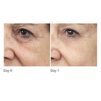 Freezeframe RevitalEYES Eye Repair Serum 15mL images 1