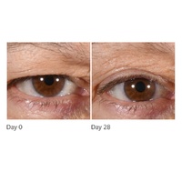 Freezeframe Non-Surgical Eyelid Lift Serum 15mL images 1