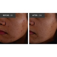 Bioderma Sébium Kerato+ Anti-Blemish Gel Cream 30mL images 3