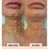 Boost Lab Edelweiss Neck Firming Serum 30mL images 3