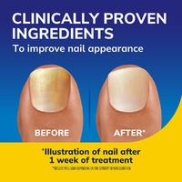 Scholl Nail Revitaliser Serum images 3