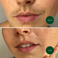 Nad's Facial Wax Strips 20 Pack images 4