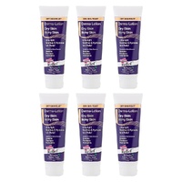 Hope's Relief Derma-Lotion 110g Pack of 6