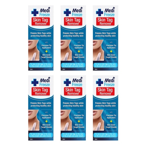 Medi Freeze Skin Tag Remover 38mL Pack of 6